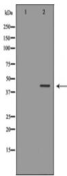 NDRG2 Antibody