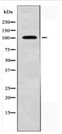 NCAM2 Antibody