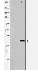 SNAI2 Antibody