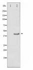 TGF beta 1 Antibody