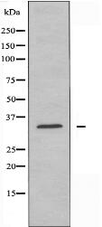 SH2D5 Antibody