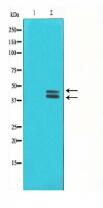 Phospho-ERK1/2 (Thr202/Tyr204) Antibody