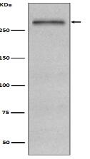 Fibronectin Antibody