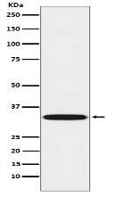 TREX1 Antibody