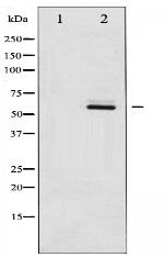 Phospho-Estrogen Receptor- beta (Ser105) Antibody