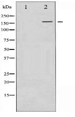 Phospho-FANCD2 (Ser222) Antibody