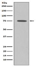 Somatostatin Receptor 2 Antibody