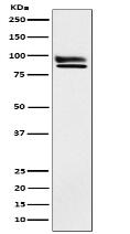 OS9 Antibody