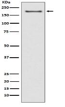 NSD3 Antibody