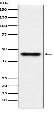 ABHD5 Antibody
