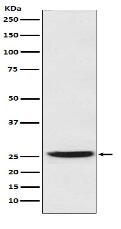 PGDH Antibody