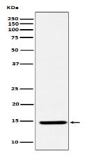 CDKN2A/p14ARF Antibody