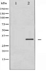 Phospho-Cyclin D1 (Ser90) Antibody