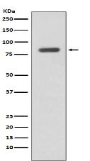 IKK beta Antibody