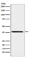 SAE1 Antibody