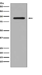 Phospho-RSK1(S380) Antibody