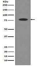 Transferrin Antibody