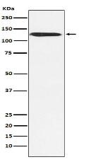 SNF2H Antibody