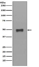 Cytokeratin 17 Antibody