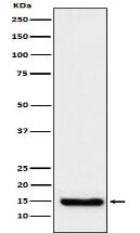 TTC11 Antibody