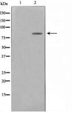Phospho-BTK(Tyr223) Antibody