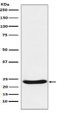 UQCRFS1 Antibody