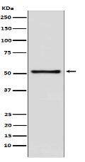 TDT Antibody