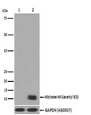Histone H4 (acetyl K5) Antibody