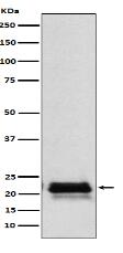 FSH beta (FSHB) Antibody