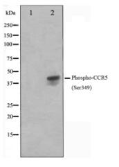 Phospho-CCR5(Ser349) Antibody