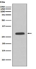 Troponin I Antibody