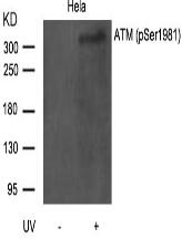 ATM(Phospho-Ser1981) Antibody