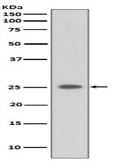 C Reactive Protein Antibody