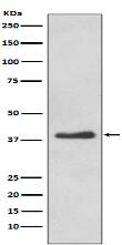 DKK1 Antibody