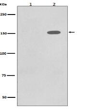 Phospho-EGFR (Y1086) Antibody