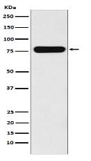 Villin-1 Antibody