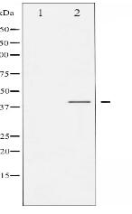 Phospho-C/EBP- alpha (Ser21) Antibody