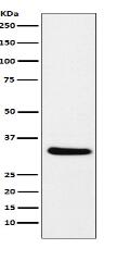 CRALBP Antibody