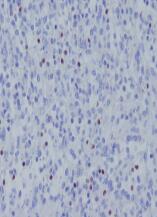 TBX21 Antibody