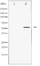 Phospho-Caspase 8 (Ser347) Antibody