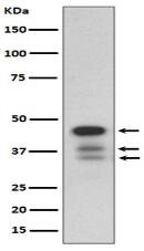 cleaved Caspase-9 Antibody