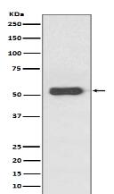 Estrogen Receptor beta Antibody