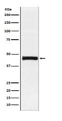 Pentraxin 3 Antibody