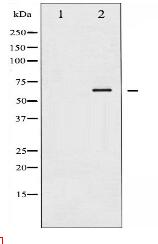 LIMK1/2 Antibody