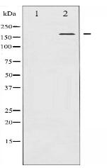 Phospho-Bcr (Tyr177) Antibody