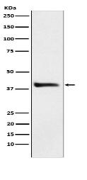 Alcohol Dehydrogenase Antibody