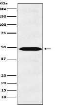 IL13 receptor alpha 1 Antibody