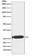 ERp29 Antibody