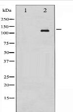 Phospho-Abl (Tyr393/412) Antibody