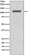 Phospho-FAK (Y397) Antibody